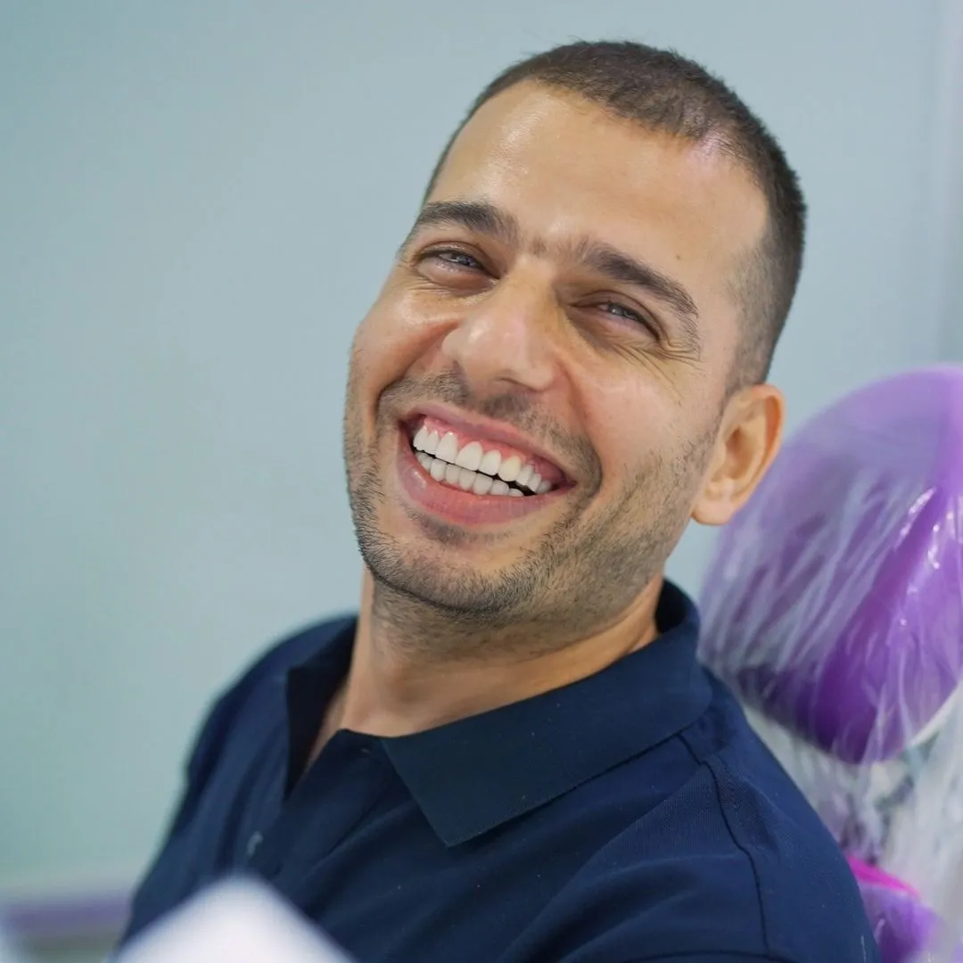 Dental Veneers in Dubai Deira