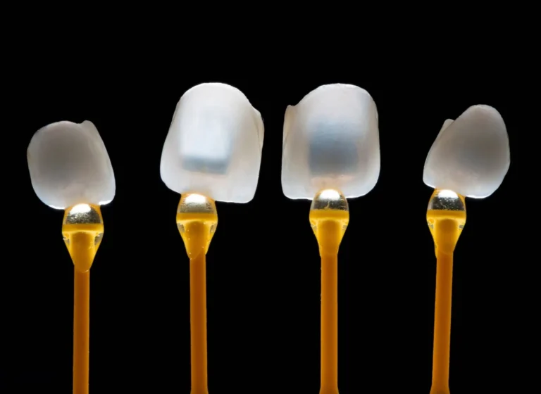 blog cover 9 can veneers correct an overbite