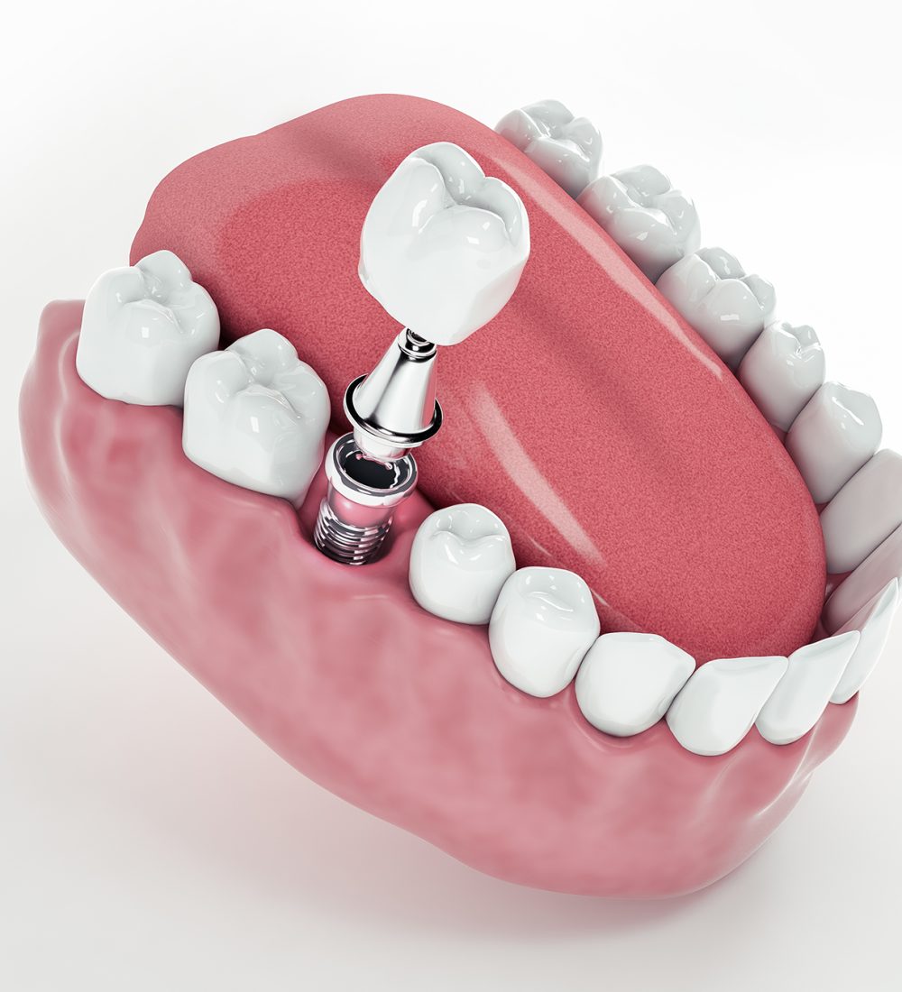 Prosthodontics