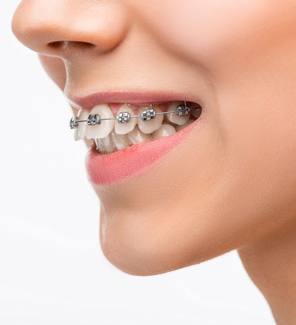 orthodontics