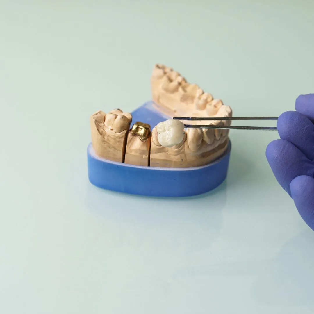 dentures in Dubai Deira