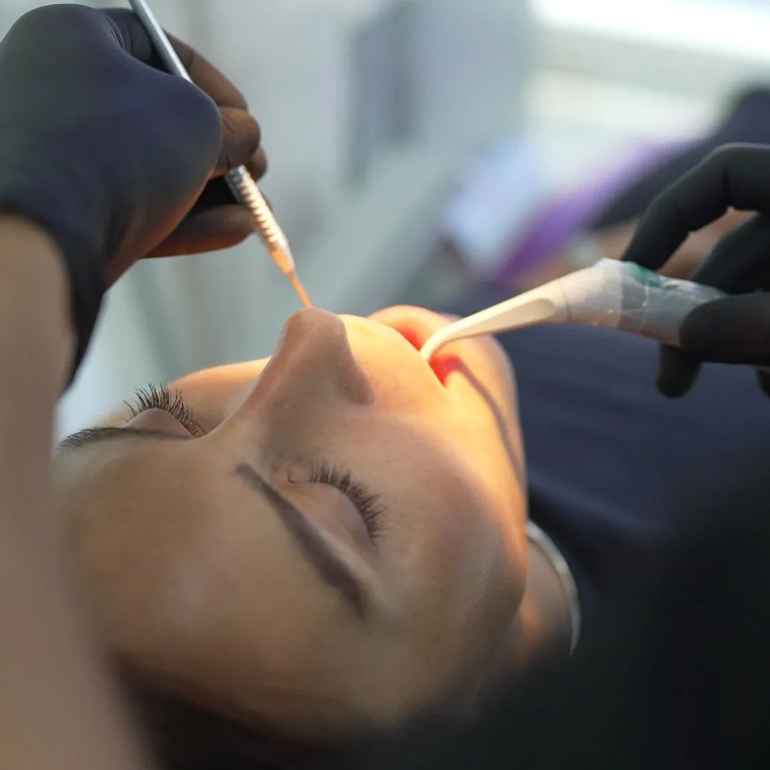 Teeth Whitening in Dubai Deira - Teeth cleaning in Dubai Deira