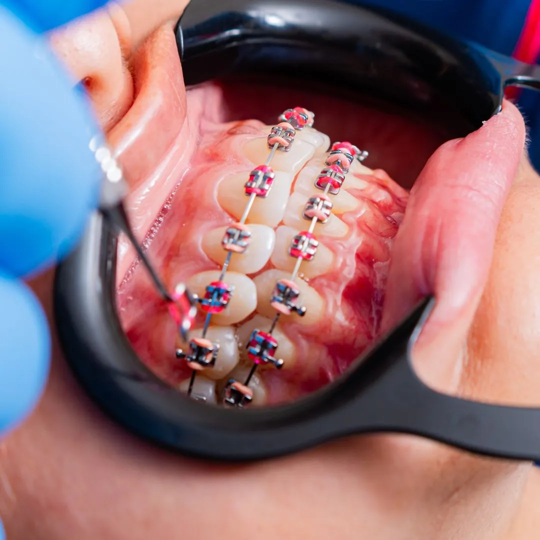 orthodontist in Dubai Deira
